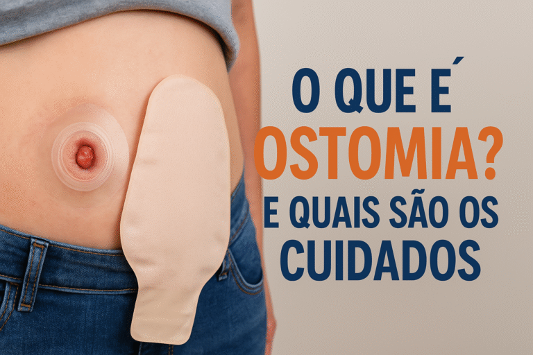 O que é Ostomia? E quais são os cuidados